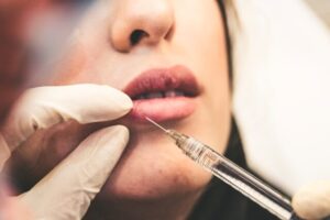 Client getting injected with a filler at 4EvaGlow