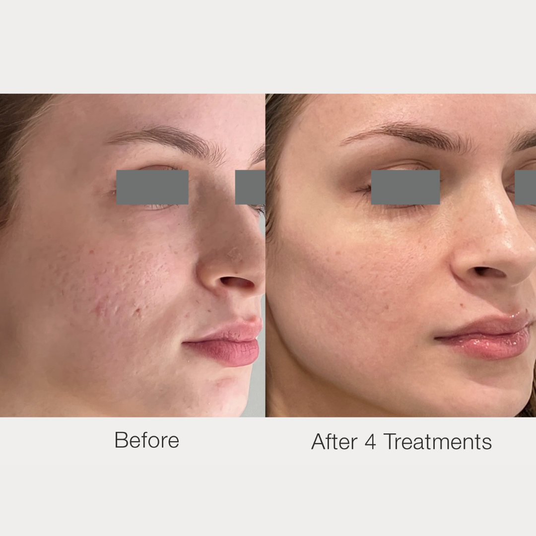 dr kwon glutathione Best Glutathione Supplement